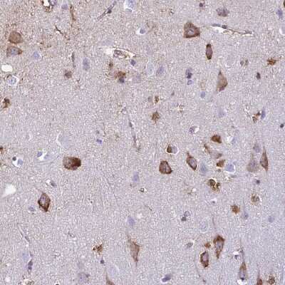 Immunohistochemistry: BACE-2 Antibody [NBP2-68624]