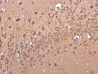 Immunohistochemistry-Paraffin: BACE-2 Antibody [NBP2-15539]