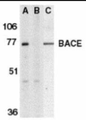 Western Blot: BACE-1 Antibody Blocking Peptide [NBP1-77307PEP]