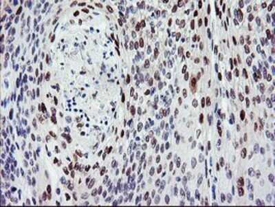 Immunohistochemistry: BACH1 Antibody (OTI4E11) - Azide and BSA Free [NBP2-70240]