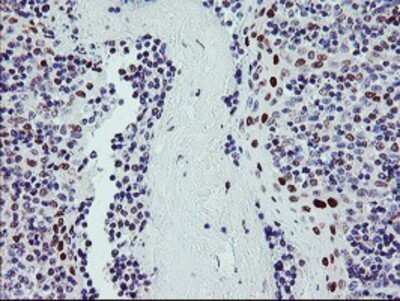 Immunohistochemistry: BACH1 Antibody (OTI4E11) - Azide and BSA Free [NBP2-70240]