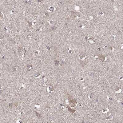 Immunohistochemistry-Paraffin: BACH2 Antibody [NBP2-14345]