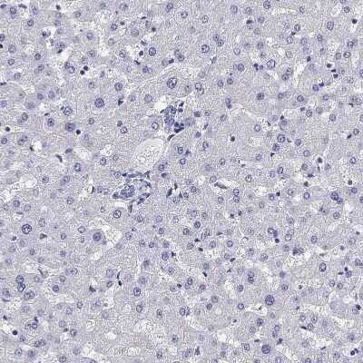 Immunohistochemistry-Paraffin: BAD-LAMP/LAMP5 Antibody [NBP1-84246]