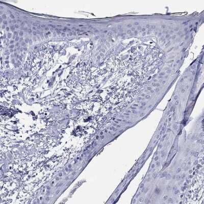 Immunohistochemistry-Paraffin: BAD-LAMP/LAMP5 Antibody [NBP1-84246]