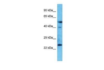 Western Blot: BAD-LAMP/LAMP5 Antibody [NBP1-62565]