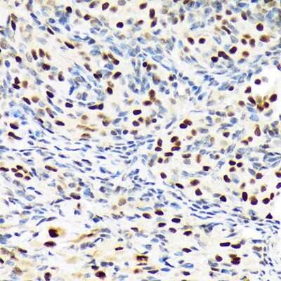Immunohistochemistry-Paraffin: BAF180/PB1 Antibody (9A8C4) [NBP3-15258]