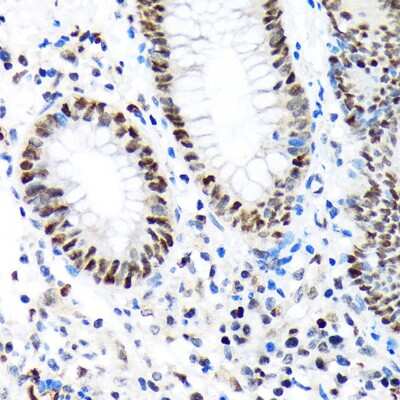 Immunohistochemistry-Paraffin: BAF180/PB1 Antibody (9A8C4) [NBP3-15258]