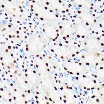 Immunohistochemistry-Paraffin: BAF180/PB1 Antibody (9A8C4) [NBP3-15258]