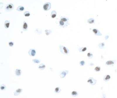 Immunocytochemistry/ Immunofluorescence: BAF180/PB1 Antibody (BL-39-2C3) [NBP2-76400]