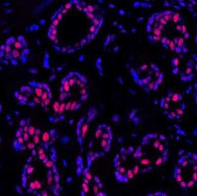 Immunocytochemistry/ Immunofluorescence: BAF180/PB1 Antibody (BL-39-2C3) [NBP2-76400]
