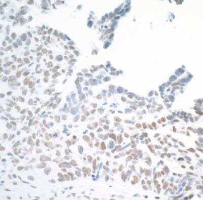 Immunohistochemistry-Paraffin: BAF180/PB1 Antibody (BL-39-2C3) [NBP2-76400]