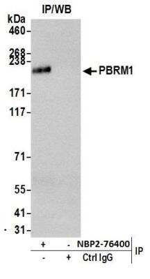 Immunoprecipitation: BAF180/PB1 Antibody (BL-39-2C3) [NBP2-76400]