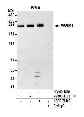 Immunoprecipitation: BAF180/PB1 Antibody (BL-39-2C3) [NBP2-76400]