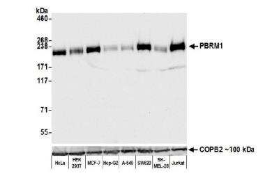 Western Blot: BAF180/PB1 Antibody (BL-39-2C3) [NBP2-76400]