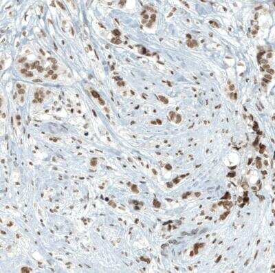 Immunohistochemistry-Paraffin: BAF180/PB1 Antibody (CL0331) [NBP2-30673]