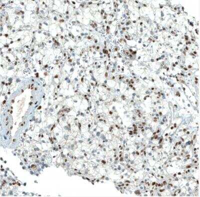 Immunohistochemistry-Paraffin: BAF180/PB1 Antibody (CL0331) [NBP2-30673]