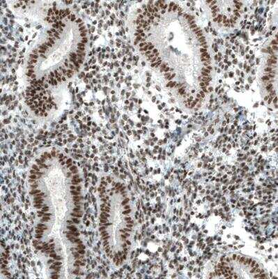 Immunohistochemistry-Paraffin: BAF180/PB1 Antibody (CL0331) [NBP2-30673]