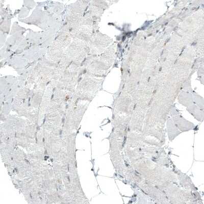 Immunohistochemistry-Paraffin: BAF180/PB1 Antibody (CL0331) [NBP2-30673]