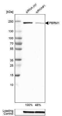 Western Blot: BAF180/PB1 Antibody (CL0331) [NBP2-30673]