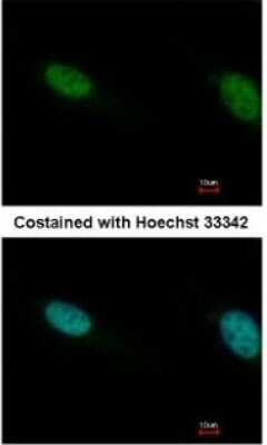 Immunocytochemistry/ Immunofluorescence: BAF180/PB1 Antibody [NBP1-32025]