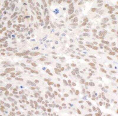 Immunohistochemistry-Paraffin: BAF180/PB1 Antibody [NB100-79833]