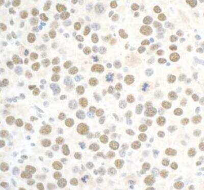 Immunohistochemistry-Paraffin: BAF180/PB1 Antibody [NB100-79833]