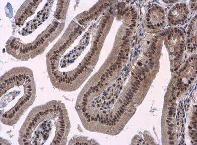 Immunohistochemistry-Paraffin: BAF180/PB1 Antibody [NBP1-32025]