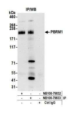 Immunoprecipitation: BAF180/PB1 Antibody [NB100-79833]