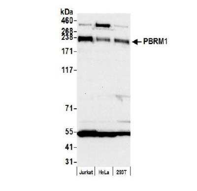 Western Blot: BAF180/PB1 Antibody [NB100-79833]