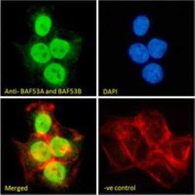 Immunocytochemistry/ Immunofluorescence: BAF53A Antibody [NB100-1421]