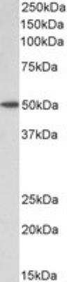 Western Blot: BAF53A Antibody [NB100-1421]
