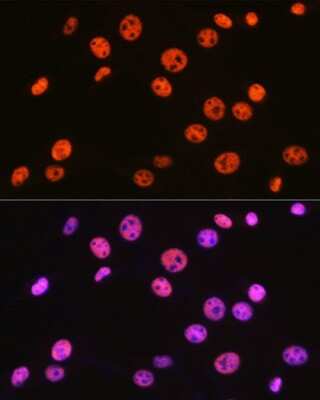 Immunocytochemistry/ Immunofluorescence: BAF57 Antibody (9L5F6) [NBP3-16279]