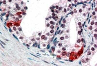 Immunohistochemistry-Paraffin: BAF57 Antibody [NB100-1297]