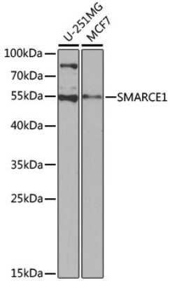 Western Blot: BAF57 AntibodyBSA Free [NBP2-92966]
