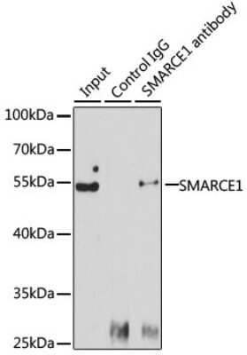 Western Blot: BAF57 AntibodyBSA Free [NBP2-92966]