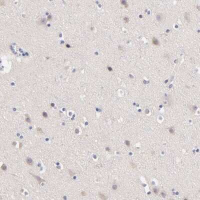 Immunohistochemistry-Paraffin: BAFFR/TNFRSF13C Antibody [NBP1-90011]
