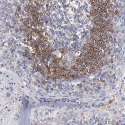 Immunohistochemistry-Paraffin: BAFFR/TNFRSF13C Antibody [NBP1-90011]