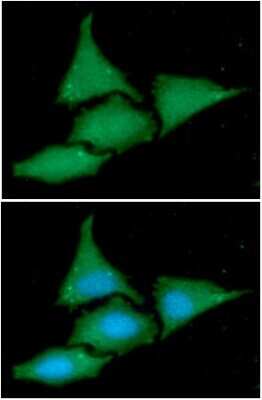 Immunocytochemistry/ Immunofluorescence: BAG2 Antibody (29E9) - BSA Free [NBP2-59476]