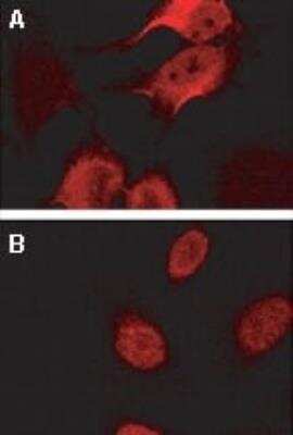Immunocytochemistry/ Immunofluorescence: BAG2 Antibody [NB100-56087]