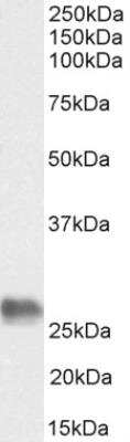 Western Blot: BAG2 Antibody [NB100-1776]