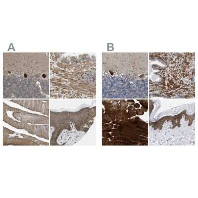 Immunohistochemistry-Paraffin: BAG3 Antibody [NBP1-86429]
