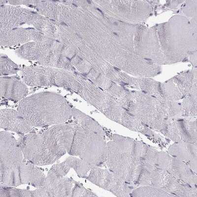 Immunohistochemistry-Paraffin: BAG5 Antibody [NBP1-86065]