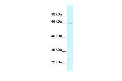 Western Blot: BAG5 Antibody [NBP2-84491]
