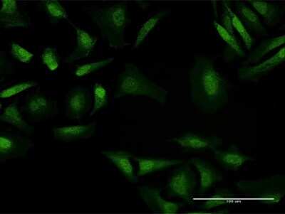 Immunocytochemistry/ Immunofluorescence: BAHD1 Antibody [H00022893-B01P]
