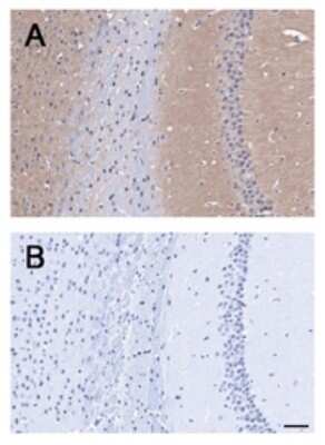 Immunohistochemistry-Paraffin: BAI1 Antibody [NB110-81586]