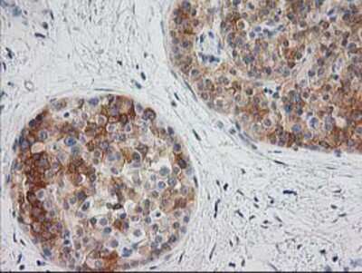 Immunohistochemistry-Paraffin: BAIAP2 Antibody (OTI 1D9) [NBP2-00810]