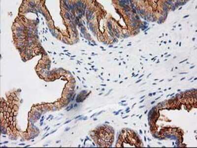 Immunohistochemistry-Paraffin: BAIAP2 Antibody (OTI 1D9) [NBP2-00810]