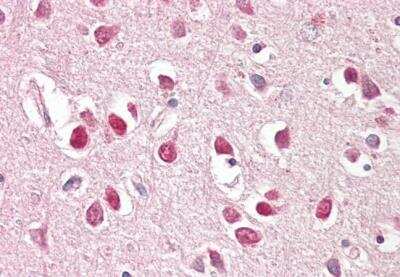 Immunohistochemistry-Paraffin: BAIAP2 Antibody [NB100-826]