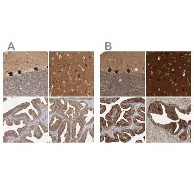 Immunohistochemistry-Paraffin: BAIAP2 Antibody [NBP1-88710]