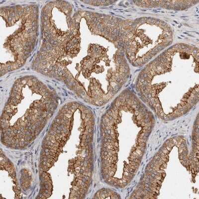 Immunohistochemistry-Paraffin: BAIAP2 Antibody [NBP1-88710]
